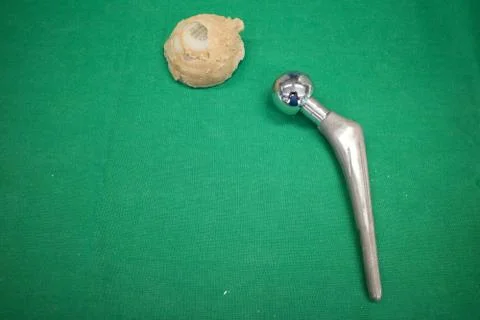 Explanted hip prosthesis was cleaned and lies on a green surgical drape. Stock Photos