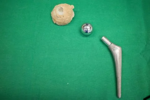 Explanted hip prosthesis was cleaned and lies on a green surgical drape. Stock Photos