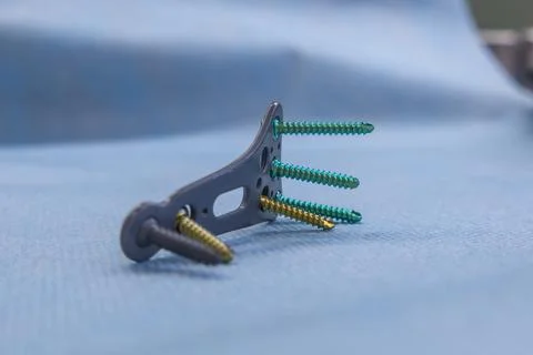 An explanted titanium plate and various titanium screws of a radius fracture Stock Photos