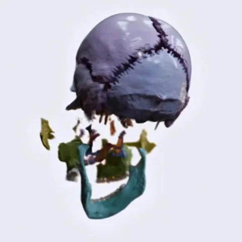 Exploding skull- bones of the neurocranium and viscerocranium 库存影片 332000742