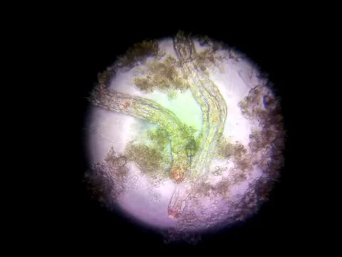 Exploring Nematode Germs Under a Microscope in a Laboratory Setting Foto stock
