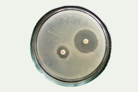 Extended spectrum beta lactamases of E coli bacteria on petri dish Stock Photos