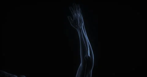 Extensor carpi ulnaris muscle in human body. X Ray. Loop Stock Footage 340065453