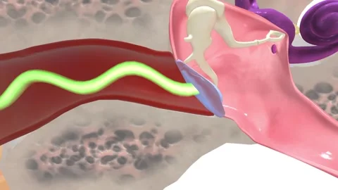 External Ear Tympanic membrane | Stock Video | Pond5