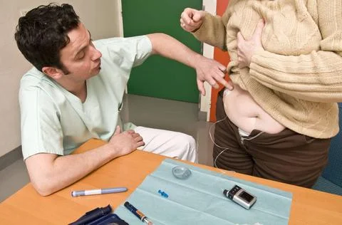  External insulin pump Consultation of functional insulin therapy, for a 5... Foto stock