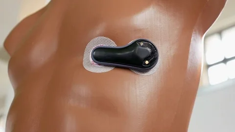 External pacemaker and cardiogram control device Stock Footage 80094799