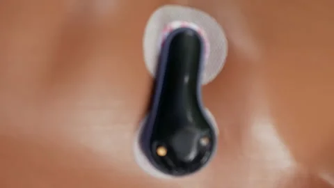 External pacemaker and cardiogram control device Stock Footage 91160453