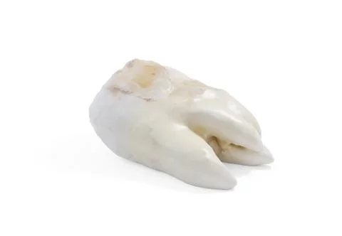 Extracted caries tooth on isolated a white background 3d illustration Stock Illustration