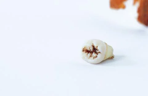 Extracted human wisdom tooth (molar) isolated on white background closeup Stock Photos