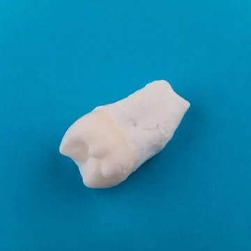 Extracted third molar without decay on blue backgroud Stock Photos