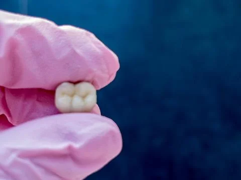 Extracted tooth held by gloved hand on blue background 스톡 사진
