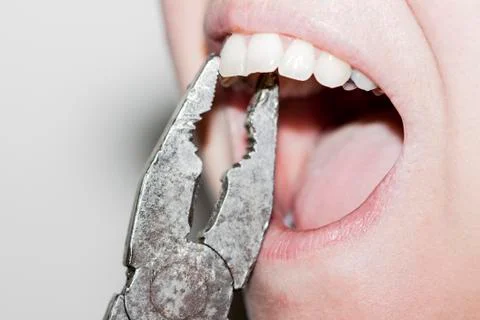 Extractions with pliers Stock Photos
