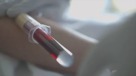 Extreme close up of blood test in progress. Video stock 48424208