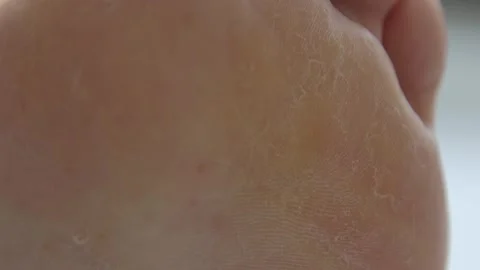 Extreme Close-up of Human Finger Tip Showing Skin Texture Detail Stock Footage 337405428