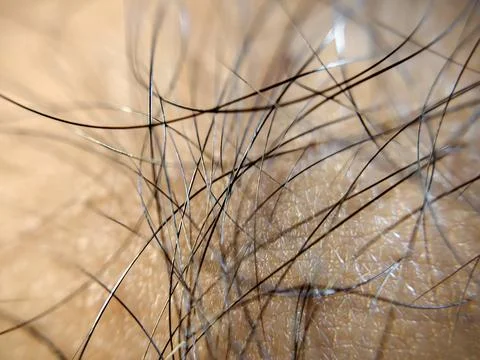 Extreme close up of human skin surface with hair Stock Photos