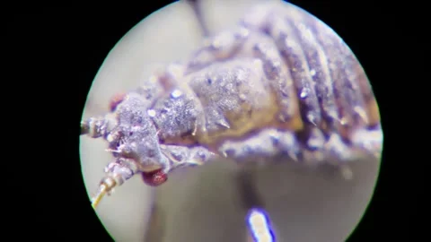 Extreme close-up of an insect moving its legs under a microscope Stock Footage 292123046