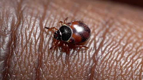 An extreme close-up, macro photograph of a tiny deer tick crawling Stock Footage 332350333