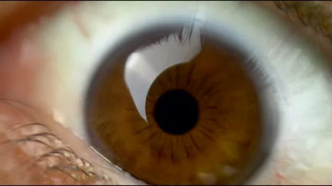Extreme close up. Man open the eyelid. Macro footage. Slow motion 4K 库存影片 281076914