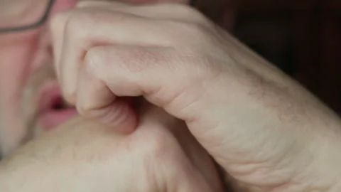 Extreme Close Up of Man Scratching Back of Hands 4K Rec709 Stock Footage 332189124