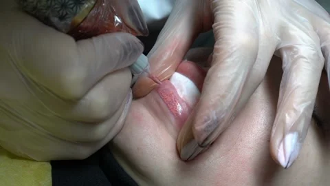 Extreme close-up of the procedure of permanent lip makeup. Video stock 99697238