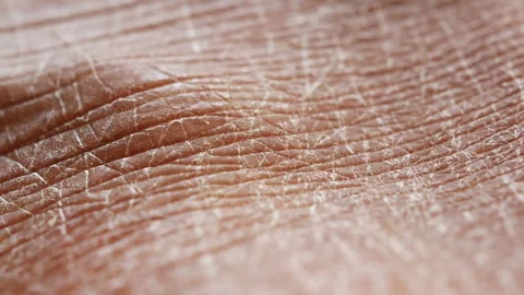 Extreme close up slow motion dry cracked skin texture detailed surface motion Stock Footage 332471109