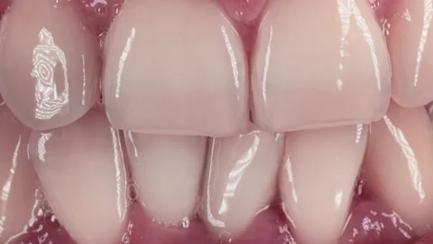 Extreme close up of white teeth.teeth whitening.full lips.smile of a man. Vidéo 174933744