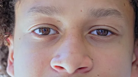 Extreme Close-Up Of Young Boy's Face With Focus On Eyes, Nose, Skin Texture, And Stock Footage 319775946