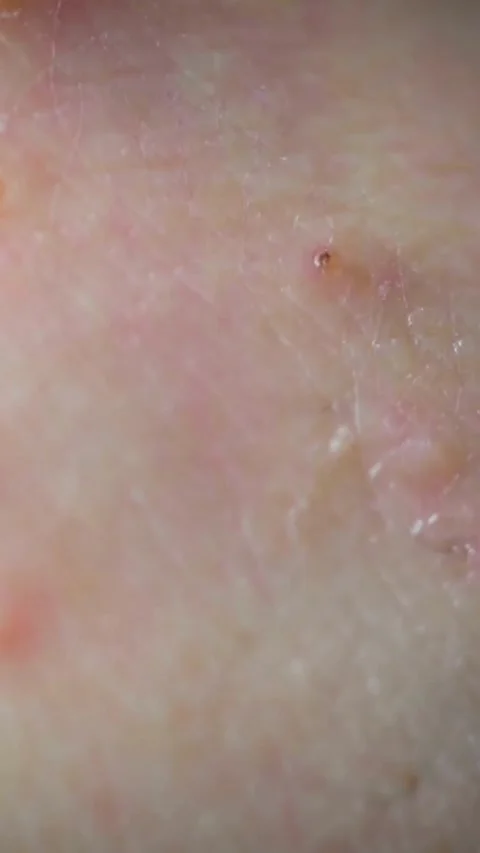 Extreme macro close up of detailed human skin texture Stock Footage 331933074