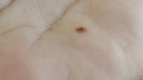 Extreme macro close up of human skin texture Stock Footage 155332333