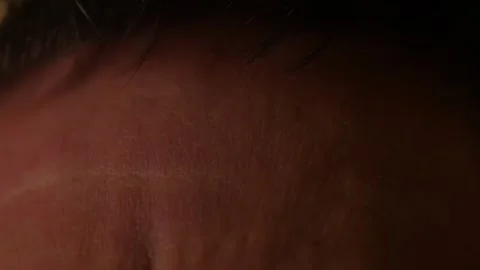 An extreme macro close-up shot of a human forehead Stock Footage 328661277