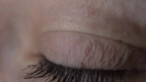 Extreme Macro Close-Up of Wide Open Eye, Shock and Surprise Reaction Stock Footage 257782092
