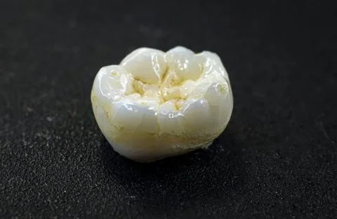 Extreme macro view of human molar crown showing details of occlusal surface.. Stock Photos