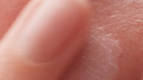 Extremely close-up cream is applied to the skin with a female finger and smeared Stock-Footage 243264488