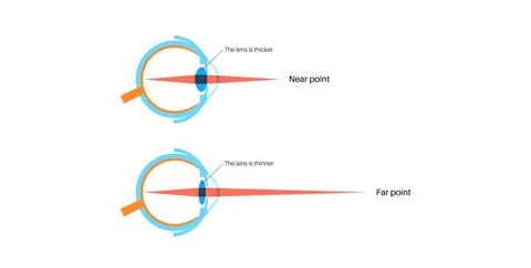 Eye accommodation poster Stock Illustration