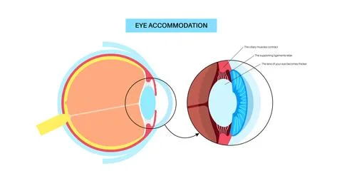 Eye accommodation poster Stock Illustration