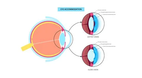 Eye accommodation poster Stock Illustration