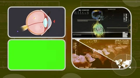 Eye - Analysis in software - examination - background yellow 03 Stock Footage 62444053