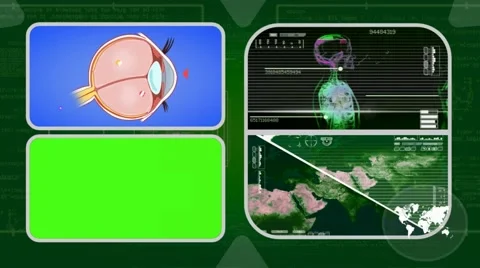 Eye - Analysis in software - examination - background green 02 Stock Footage 62444120