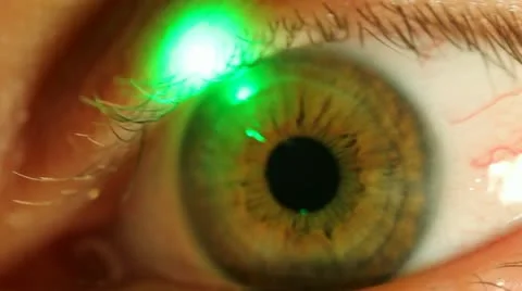 Eye and green ray Stock Footage 10826478