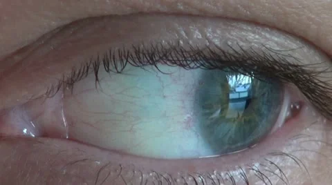 Eye close-up Video stock 20448697