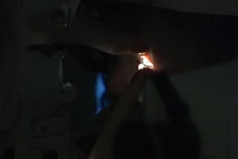 Eye correction Stock Footage 10766260