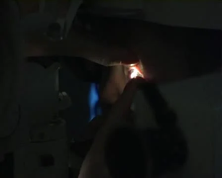 Eye correction Stock Footage 10766265