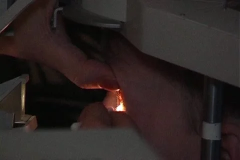Eye correction Stock Footage 10766277