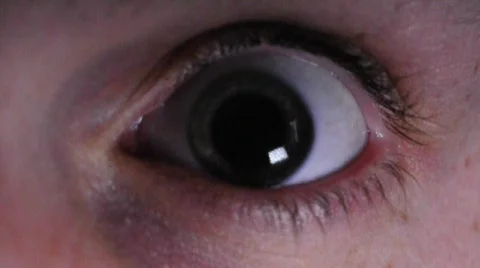 Eye dilates in bright light Stock Footage 548163