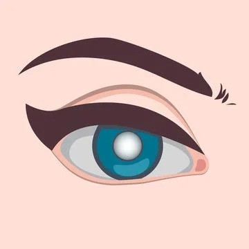 Eye disease vector illustration, Glaucoma cataract and healthy eye disease and Stock Illustration