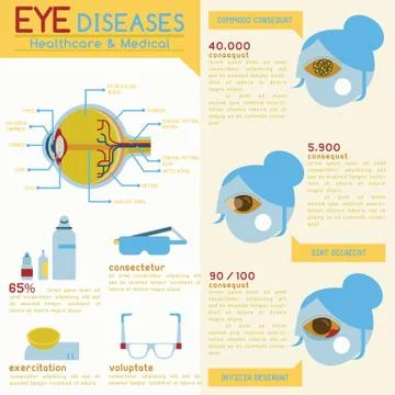Eye diseases set Illustrazione stock
