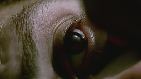 Eye drop into eyeball slow motion Stockbeeldmateriaal 11458740