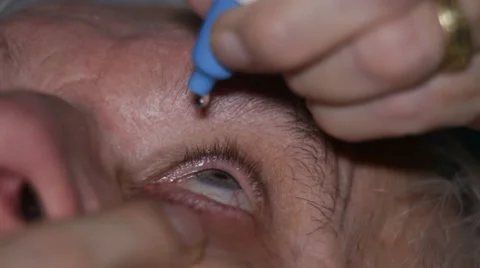 Eye drop Stock Footage 33948504