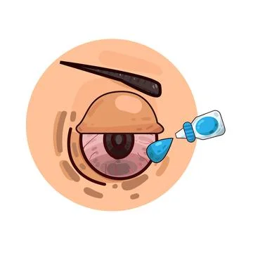 Eye drops illustration Stock Illustration
