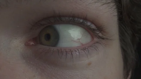 Eye with eyeball looking worrying around fast in macro closeup Video stock 124014183